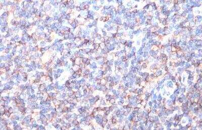 Immunohistochemistry-Paraffin: HLA A Antibody [NBP2-14982]