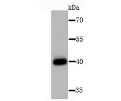 Western Blot: HLA Class I Antibody [NBP2-75928]