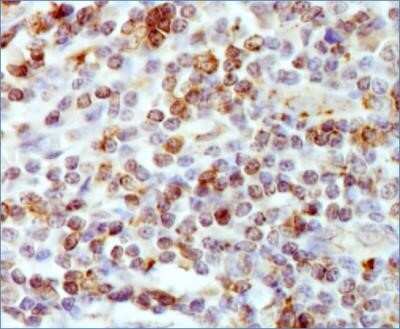 Immunohistochemistry: HLA DMA Antibody (5C9NB) - Azide Free [NBP2-44301]