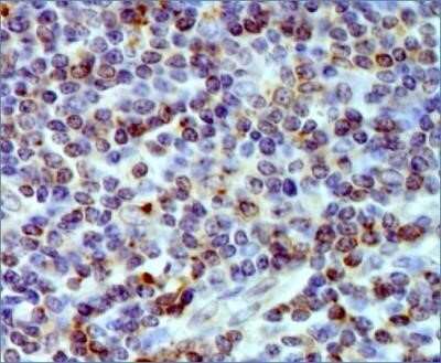 Immunohistochemistry-Paraffin: HLA DMA Antibody (6B12NB) - Azide Free [NBP2-44304]