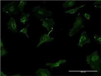 Immunocytochemistry/ Immunofluorescence: HLA DMB Antibody (2D3) [H00003109-M02]