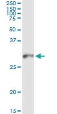 Immunoprecipitation: HLA DMB Antibody (4D12) [H00003109-M08]