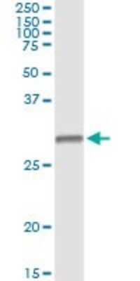 Immunoprecipitation: HLA DMB Antibody (7D11) [H00003109-M07]