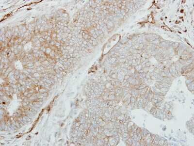 Immunohistochemistry-Paraffin: HLA DMB Antibody [NBP1-31138]
