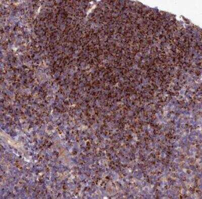Immunohistochemistry-Paraffin: HLA DOA Antibody [NBP1-91993]