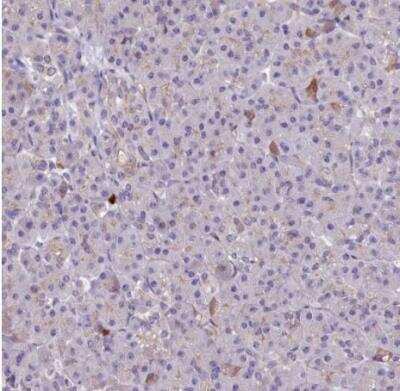 Immunohistochemistry-Paraffin: HLA DOA Antibody [NBP1-91993]