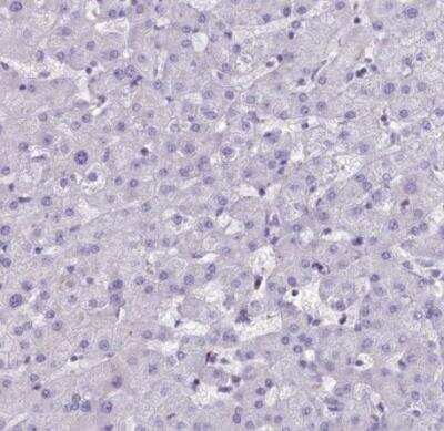 Immunohistochemistry-Paraffin: HLA DOA Antibody [NBP1-91993]