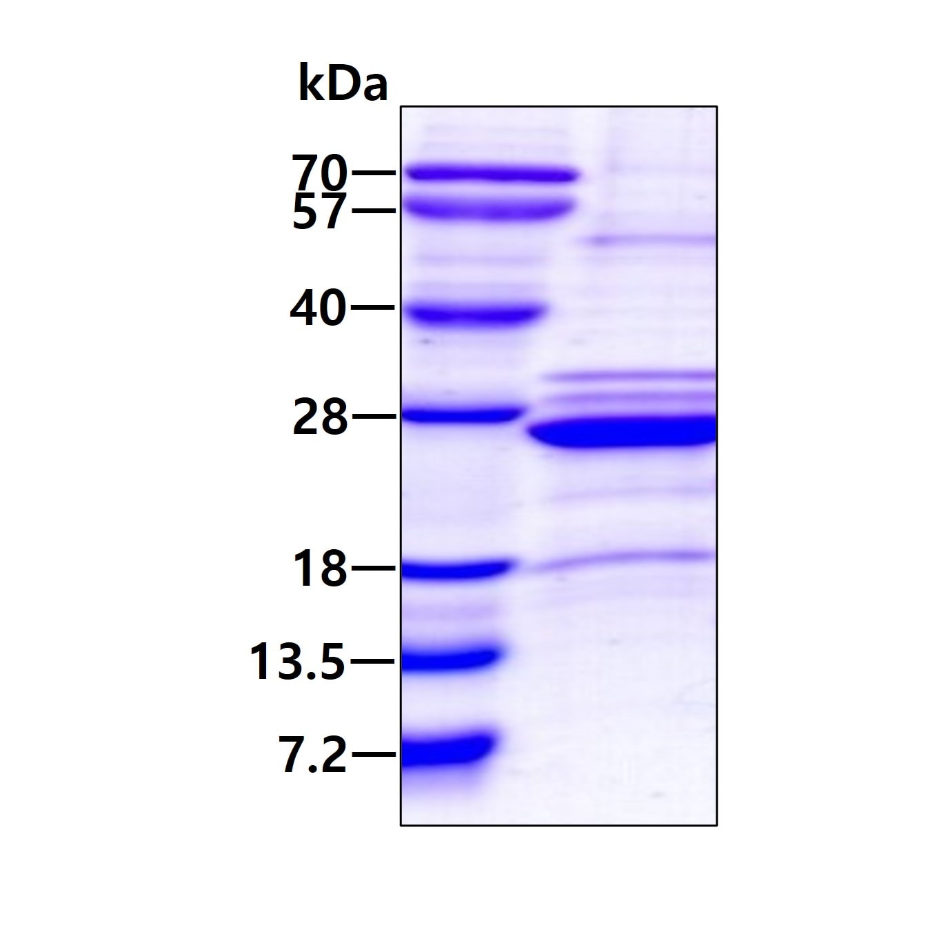 SDS-PAGE: Recombinant Human HLA DOA His Protein [NBP2-23211]