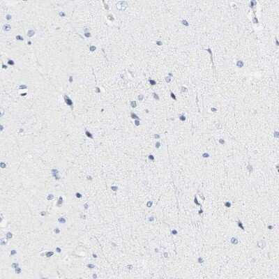 Immunohistochemistry-Paraffin: HLA DOB Antibody [NBP1-87469]