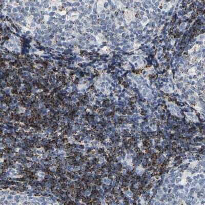 Immunohistochemistry-Paraffin: HLA DOB Antibody [NBP1-87469]