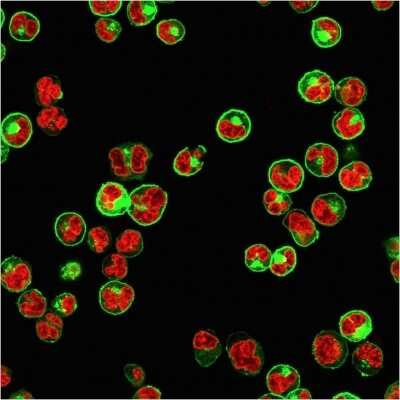 Immunocytochemistry/ Immunofluorescence: HLA DQ/DR/DP Antibody (CR3/43) [NBP2-53380]