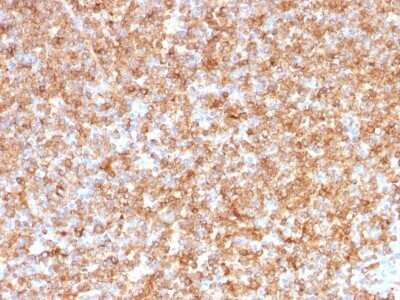 Immunohistochemistry-Paraffin: HLA DQ/DR/DP Antibody (CR3/43) [NBP2-53380]