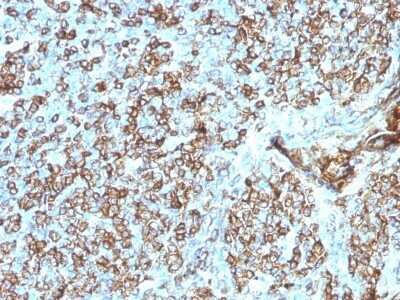 Immunohistochemistry-Paraffin: HLA DQ/DR/DP Antibody (CR3/43) [NBP2-53380]