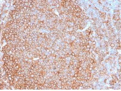 Immunohistochemistry-Paraffin: HLA DQ/DR/DP Antibody (HLA-Pan/2967R) [NBP2-79709]