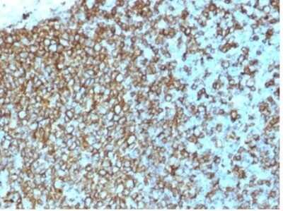 Immunohistochemistry-Paraffin: HLA DQ/DR/DP Antibody (rHLA-Pan/3475) - Azide and BSA Free [NBP3-08644]