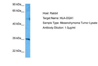 Western Blot: HLA DQ3 Antibody [NBP2-84068]