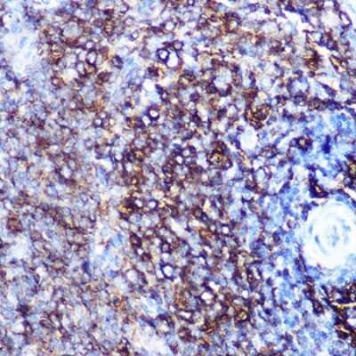 Immunohistochemistry-Paraffin: HLA DQA1 Antibody (7W0M7) [NBP3-15364]