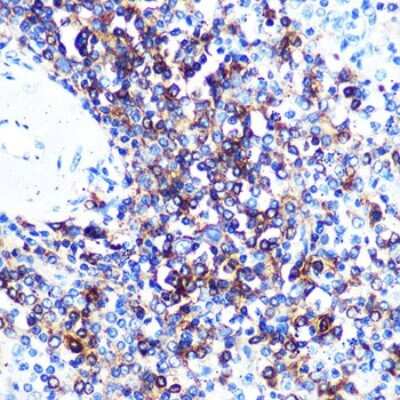 Immunohistochemistry-Paraffin: HLA DQA1 Antibody (7W0M7) [NBP3-15364]