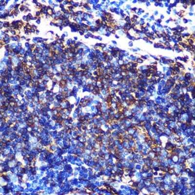 Immunohistochemistry-Paraffin: HLA DQA1 Antibody (7W0M7) [NBP3-15364]