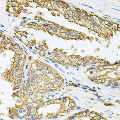 Immunohistochemistry-Paraffin: HLA DQA1 Antibody - BSA Free [NBP3-03602]