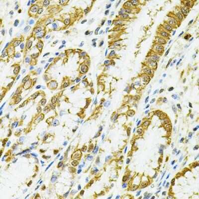 Immunohistochemistry-Paraffin: HLA DQA1 Antibody - BSA Free [NBP3-03602]