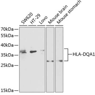Western Blot: HLA DQA1 AntibodyBSA Free [NBP3-03602]