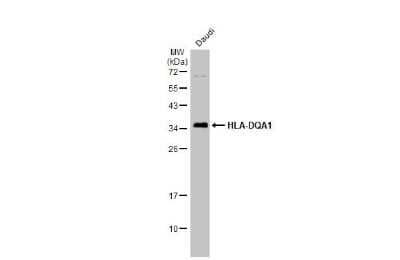 Western Blot: HLA DQA1 Antibody [NBP3-13483]