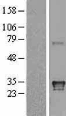Western Blot: HLA DQA1 Overexpression Lysate [NBL1-11584]