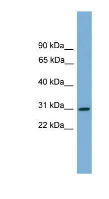 Western Blot: HLA DQA2 Antibody [NBP1-56993]