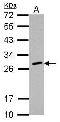 Western Blot: HLA DQB2 Antibody [NBP2-14984]