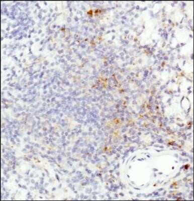 Immunohistochemistry: HLA-DR Antibody (L243) - Azide and BSA Free [NBP2-80773]