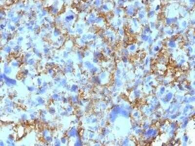 Immunohistochemistry-Paraffin: HLA-DR Antibody (LN-3) - Azide and BSA Free [NBP2-47670]