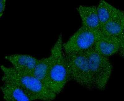 Immunocytochemistry/ Immunofluorescence: HLA DR/DP Antibody (SC06-78) [NBP2-67610]