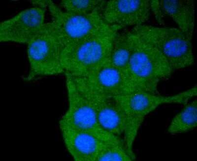Immunocytochemistry/ Immunofluorescence: HLA DR/DP Antibody (SC06-78) [NBP2-67610]