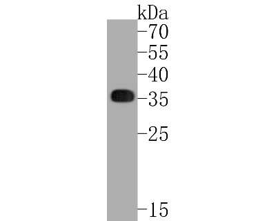 Western Blot: HLA DR/DP Antibody (SC06-78) [NBP2-67610]