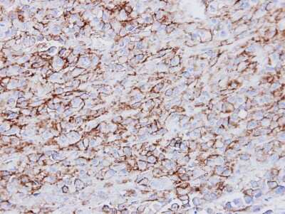 Immunohistochemistry-Paraffin: HLA DRA Antibody [NBP1-33458]