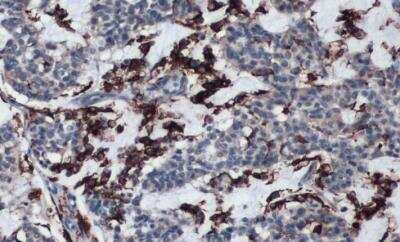 Immunohistochemistry-Paraffin: HLA DRA Antibody [NBP1-33458]