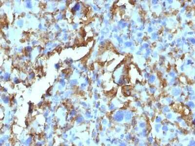 Immunohistochemistry-Paraffin: HLA DRB1 Antibody (HLA-DRB/1067) - Azide and BSA Free [NBP2-47671]