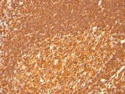 Immunohistochemistry-Paraffin: HLA DRB1 Antibody (HLA-DRB/1067) - Azide and BSA Free [NBP2-47671]