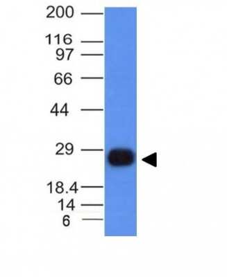 Western Blot: HLA DRB1 Antibody (HLA-DRB/1067) [NBP2-45314]