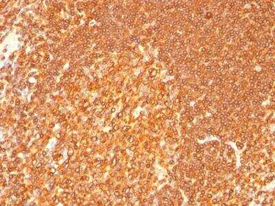 Immunohistochemistry-Paraffin: HLA DRB1 Antibody (LN-3 + HLA-DRB/1067) - IHC-Prediluted [NBP2-48136]