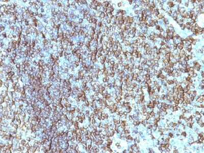 Immunohistochemistry-Paraffin: HLA DRB1 Antibody (SPM288) [NBP2-45312]