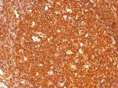 Immunohistochemistry-Paraffin: HLA DRB1 Antibody (SPM289) - IHC-Prediluted [NBP2-48113]