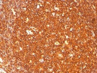 Immunohistochemistry-Paraffin: HLA DRB1 Antibody (SPM289) [NBP2-45311]
