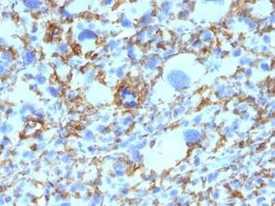Immunohistochemistry-Paraffin: HLA DRB1 Antibody (SPM423) [NBP2-45313]
