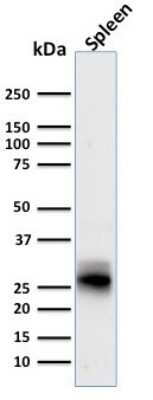 Western Blot: HLA DRB1 Antibody (SPM423) [NBP2-45313]