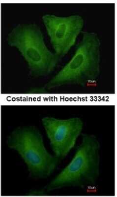 Immunocytochemistry/ Immunofluorescence: HLA DRB3 Antibody [NBP1-33666]