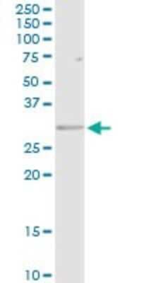 Western Blot: HLA DRB5 Antibody [H00003127-D01P]