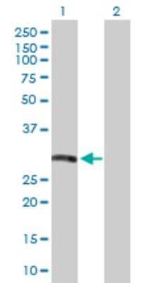 Western Blot: HLA DRB5 Antibody [H00003127-D01P]