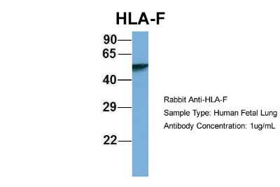 Western Blot: HLA F Antibody [NBP1-59524]